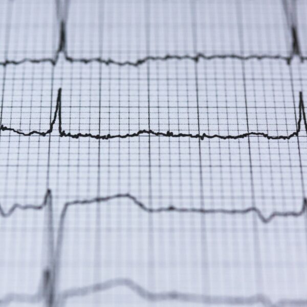 Check For A Heartbeat In Your Marketing Automation Platform